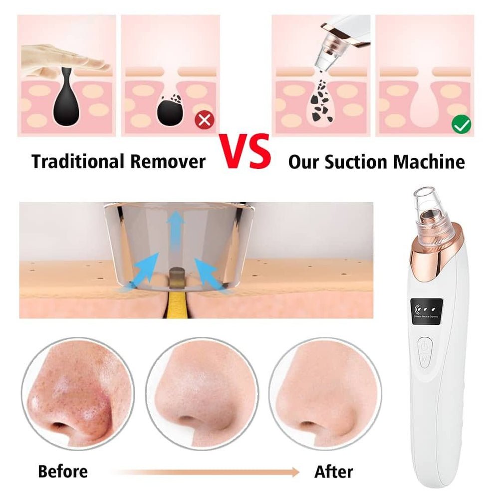 5 in 1 Blackhead remover | Derma Suction | Rechargeable | Free Gift Card 🎁 - Nuvenza