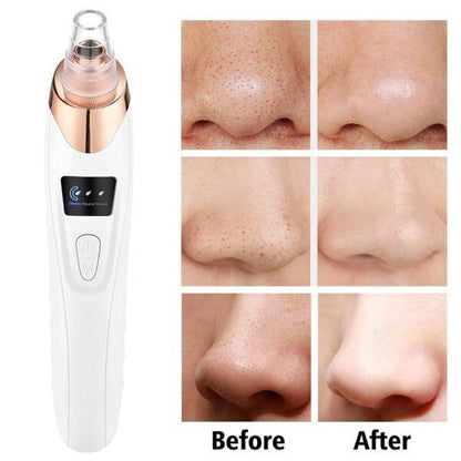 5 in 1 Blackhead remover | Derma Suction | Rechargeable | Free Gift Card 🎁 - Nuvenza